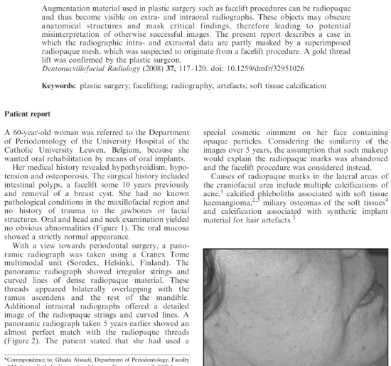 Picture of Soft tissue augmentation of the cheeks detected on intra- and extraoral radiographs: a case report