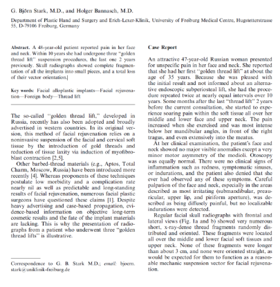 Picture of The ‘‘Golden Thread Lift’’: Radiologic Findings